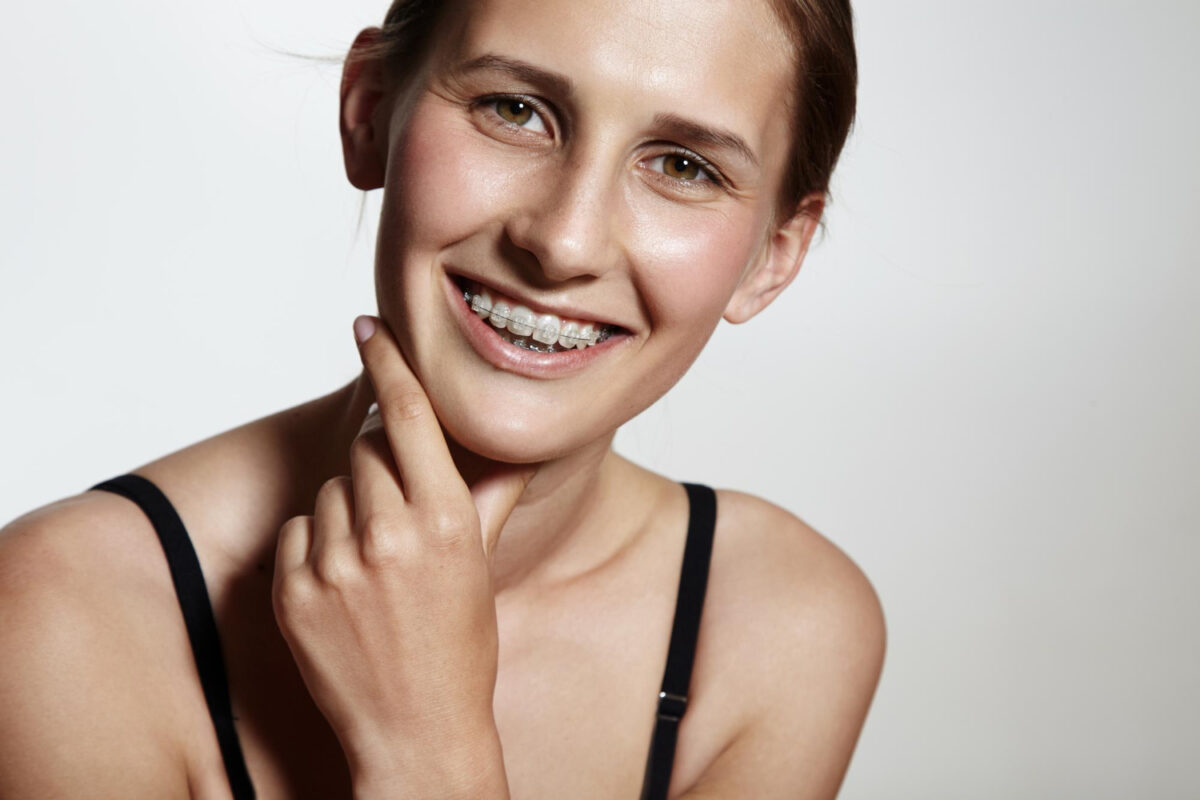 ceramic braces