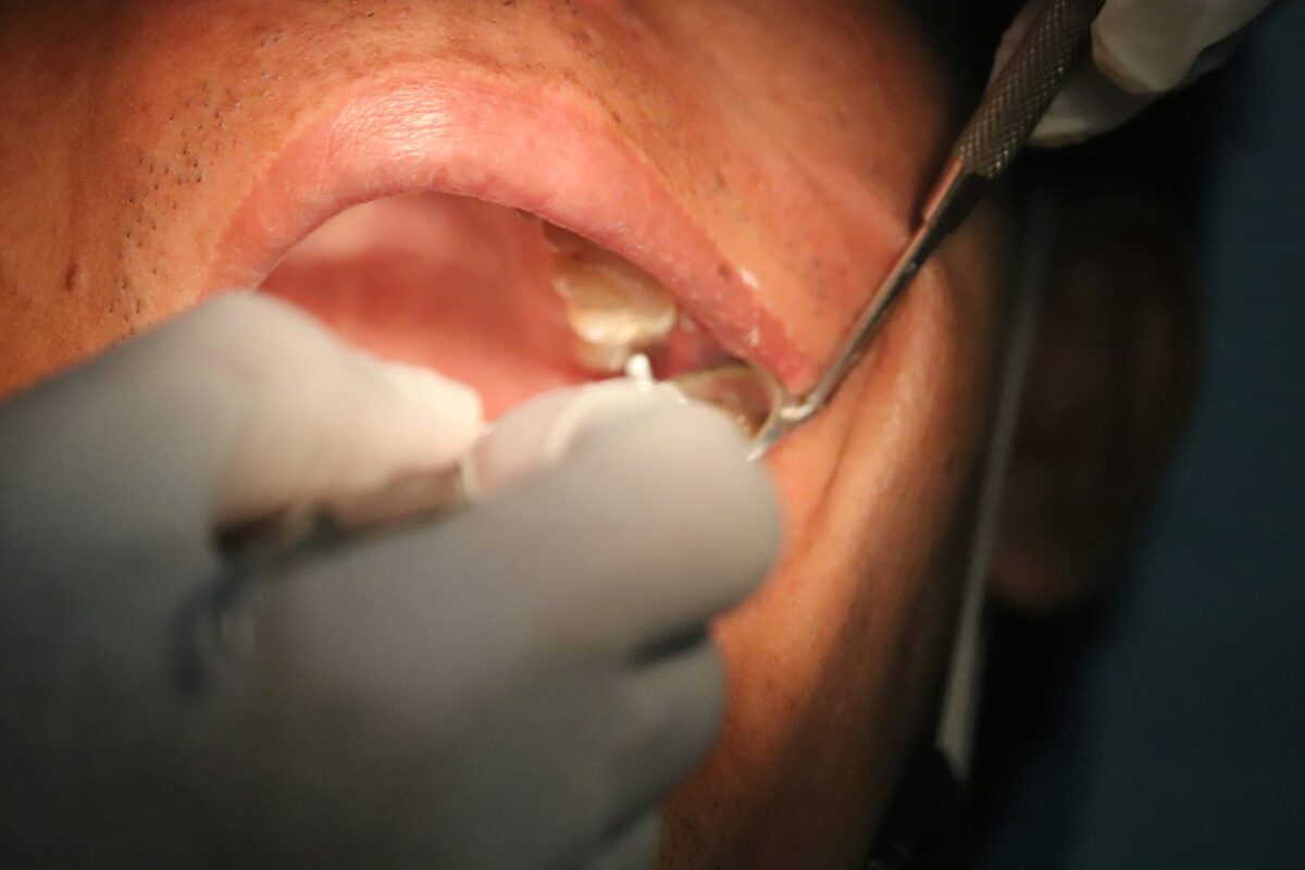 Orthodontic Treatment